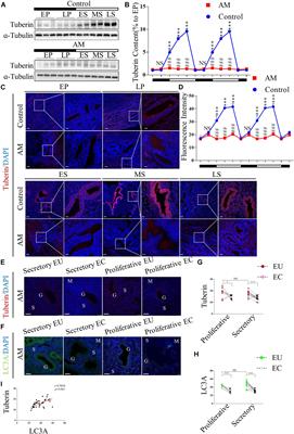 Hypo-Expression of Tuberin Promotes Adenomyosis via the mTOR1-Autophagy Axis